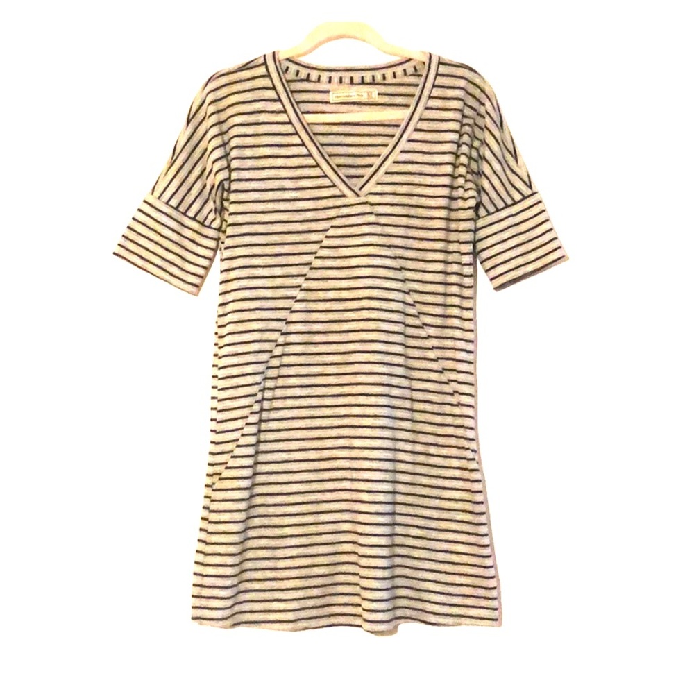 Abercrombie & Fitch Striped Dress
